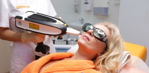 Lifting po trzydziestu latach